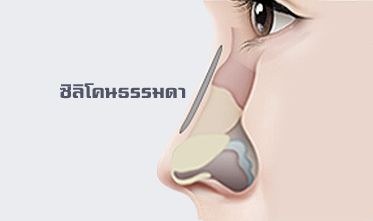 regular-nose-surgery