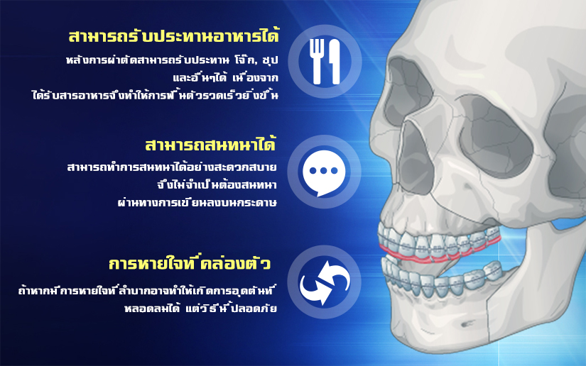 men-orthognathic-surgery-no-tie-two-jaw-surgery