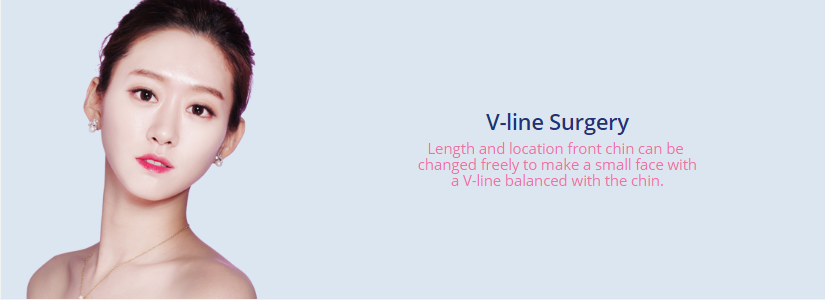 V Line Definition v-line surgery - IDHOSPITAL