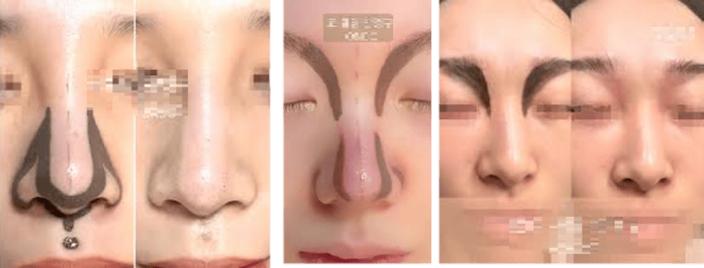 รอยสักบนจมูก