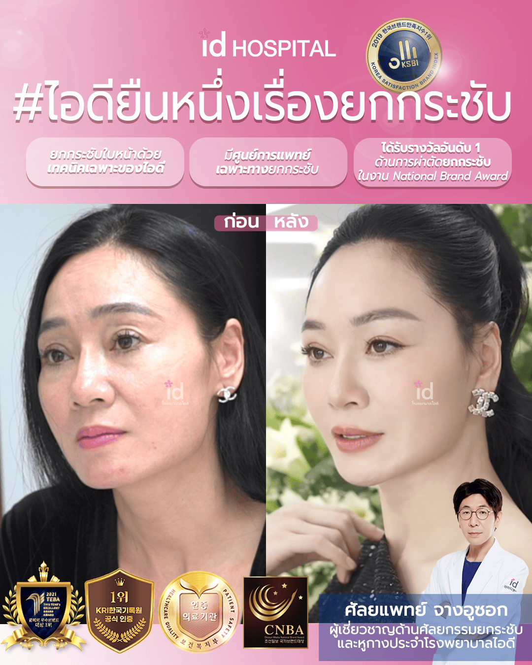 ภาพรีวิวก่อนและหลังชะลอวัย เคสที่ 19630