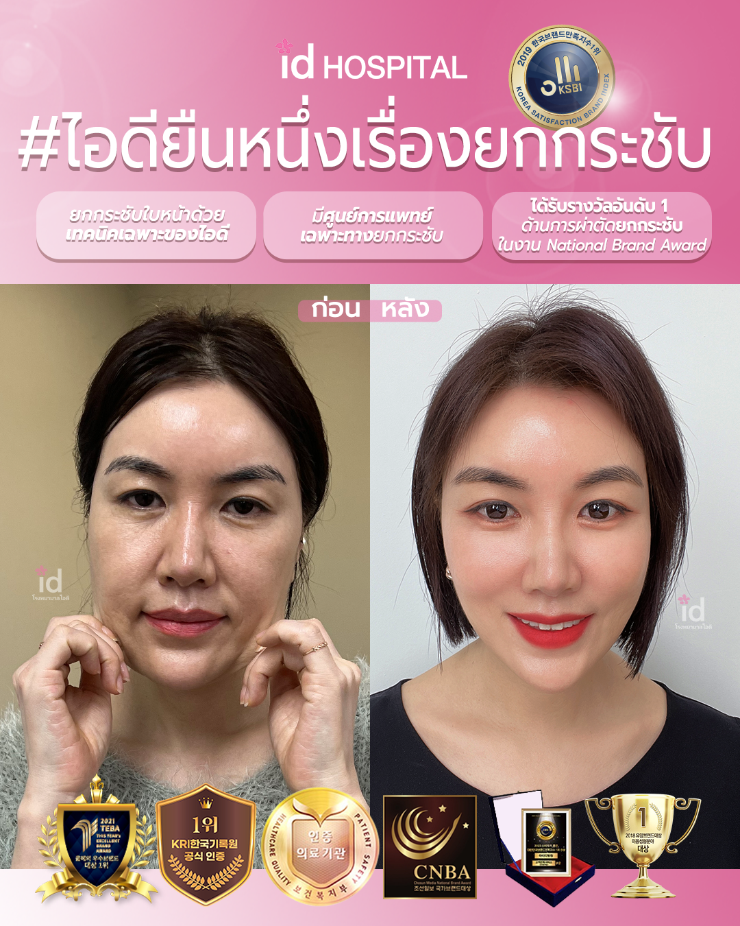 ภาพรีวิวก่อนและหลังชะลอวัย เคสที่ 19956