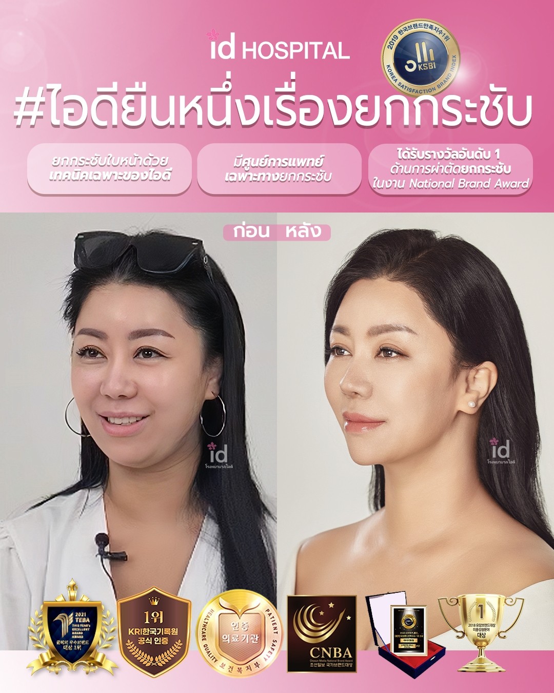 ภาพรีวิวก่อนและหลังชะลอวัย เคสที่ 20073