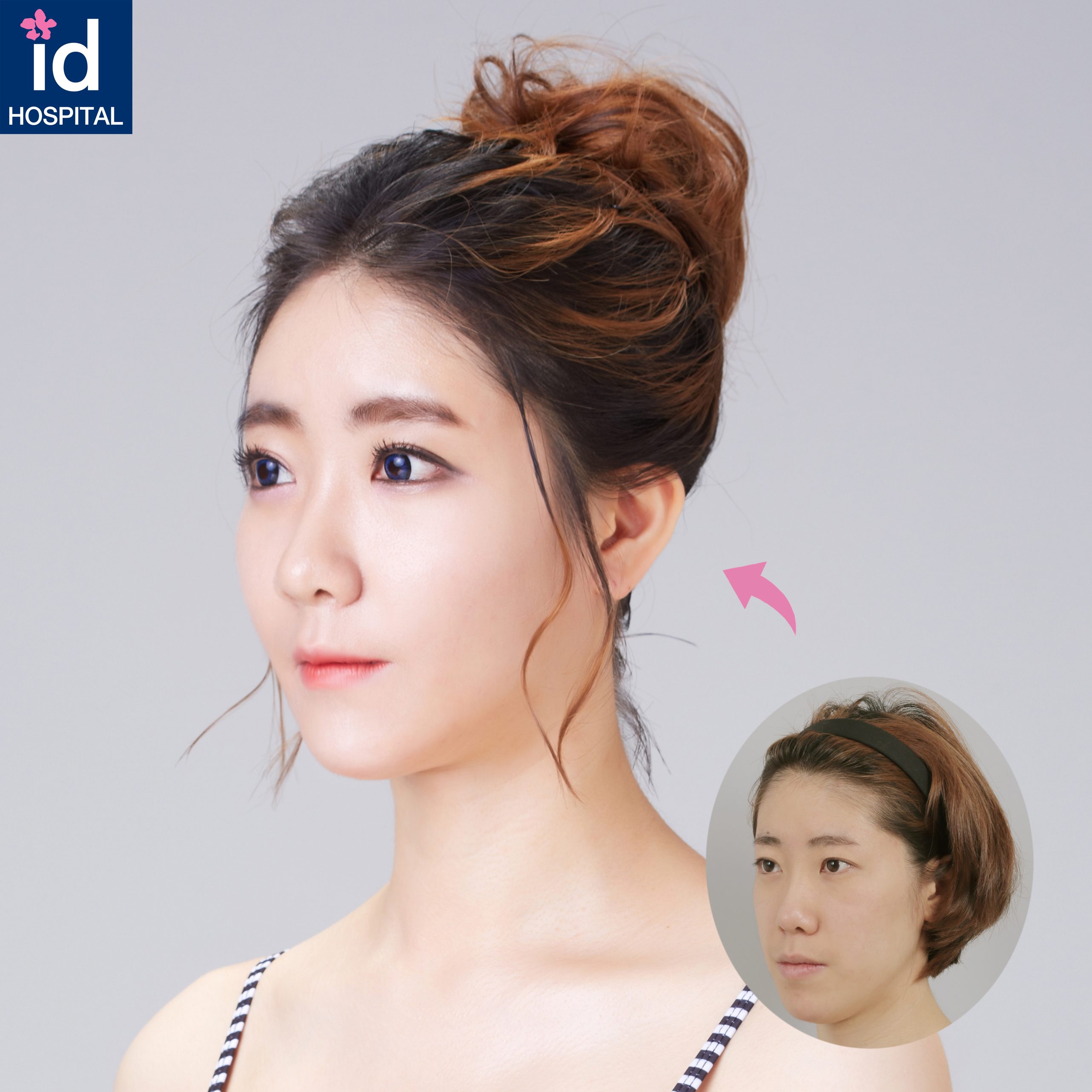 These Transformations Are Real. ID’s Real Plastic Surgery Makeover ...